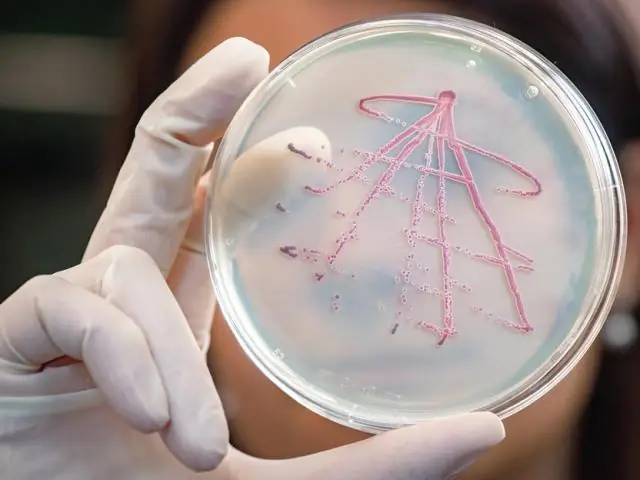 Выживание: для бактерий соседи совместно определяют, какая клетка умирает первой