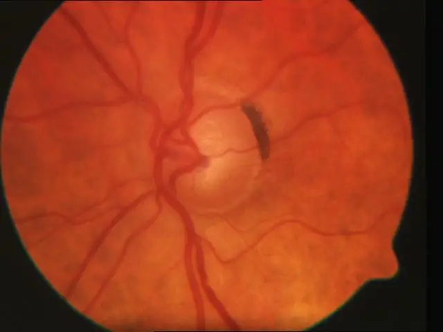 Левый глаз? Правый глаз? Американские малиновки отдают предпочтение яйцам-приманкам