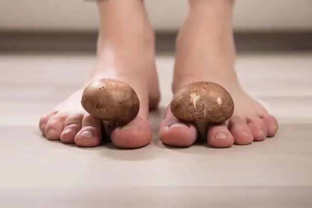 Препятствия для диагностики грибковых инфекций