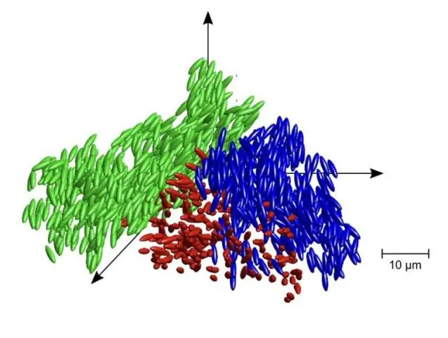 Трудности перевода: исследователи обнаружили, что ген-переводчик может играть роль в заболевании