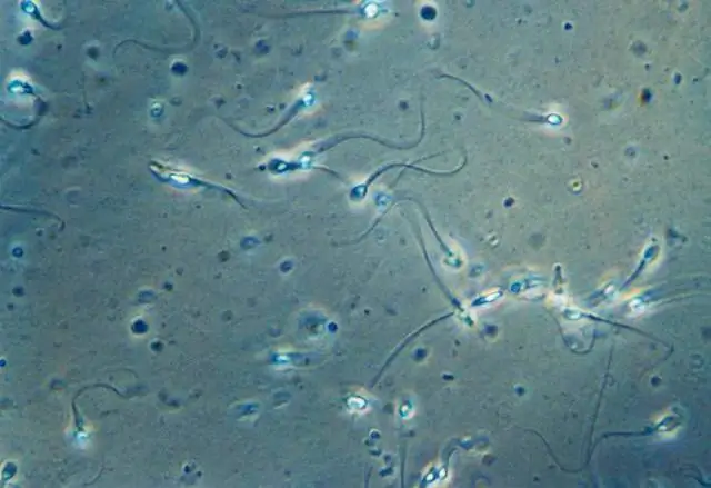 Fracking вызывает глобальный всплеск атмосферного метана, показывают исследования