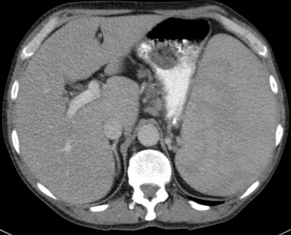Эмбриология: последовательность рефлекторных сокращений запускает формирование конечностей