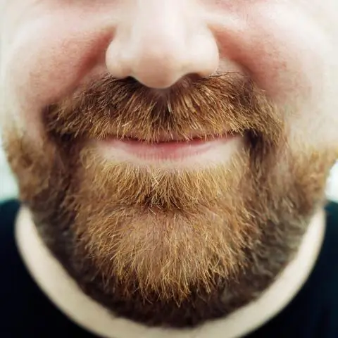 От одного гена зависит, будет ли у мухи хорошее обоняние или зрение