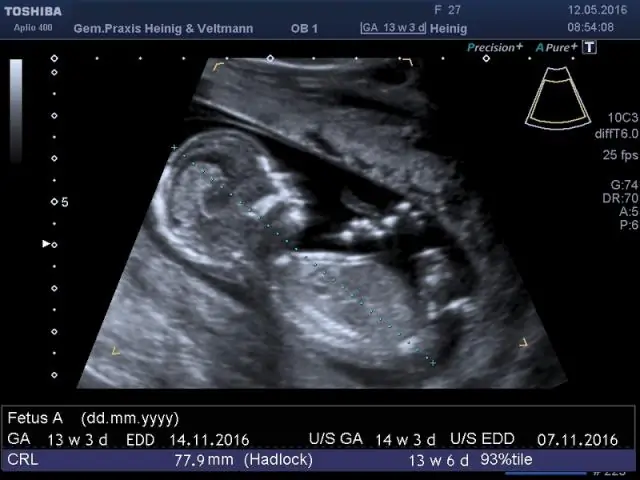 Внеклеточная ДНК выявляет патогены и количественно оценивает ущерб