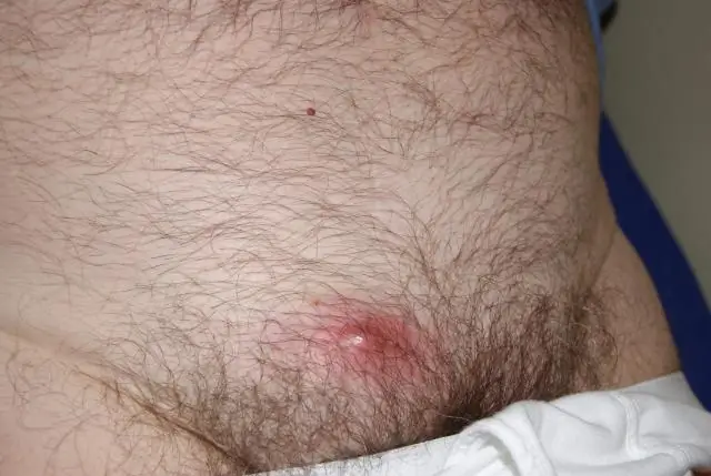 Риск заболеваний скота связан со стилем управления стадом