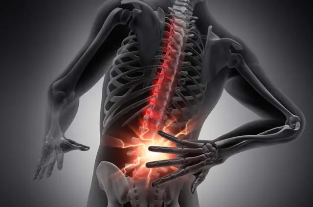 Боль в жерехе: сети для отпугивания птиц создают убежище для жалящих вредителей: ядовитые гусеницы процветают под сетками деревьев