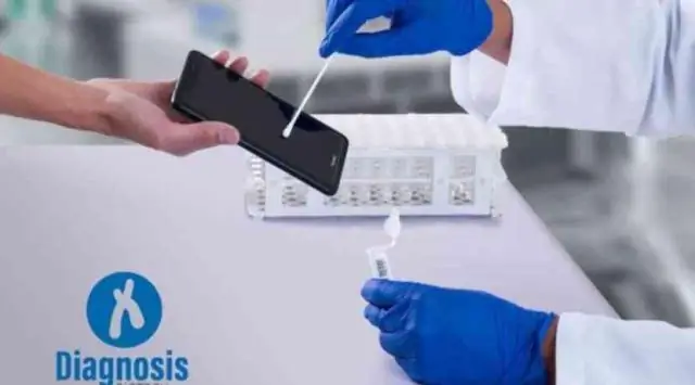 Новый способ проверки на лекарственно-устойчивые инфекции: ученые разработали метод проверки устойчивости инфекции к обычным антибиотикам