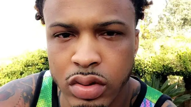 Тревожное поведение барсуков в зоне выбраковки: выжившие после выбраковки покрывают на 61% большую территорию, что потенциально увеличивает риск передачи инфекции крупному рогатому скоту