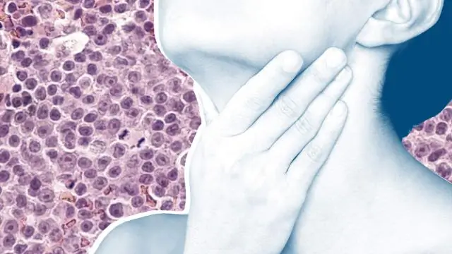 Новое исследование объясняет, как ВИЧ избегает заражения ZAP