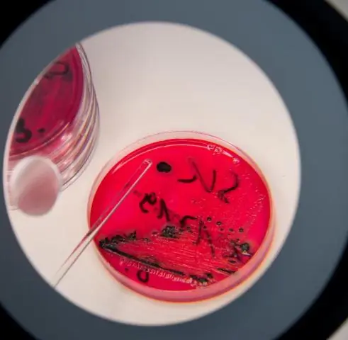 Природа сальмонеллы меняется, и это становится все более жестоким