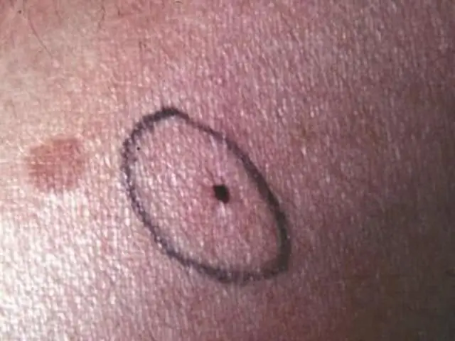 Комары чувствуют токсины через ноги