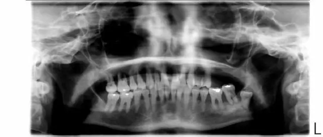 Улучшено функционирование разнообразных ландшафтных мозаик