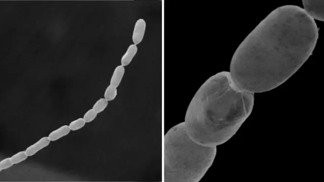 Вглядываясь в прошлое, ученые обнаруживают, что бактерии превратили вирусную угрозу, чтобы выжить: новое исследование Университета Индианы показывает, что бактерии развили новые гены от вирусных атак,