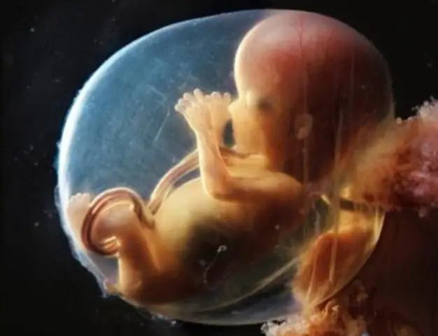 Мутация делает бульдогов и норвич-терьеров более восприимчивыми к проблемам с дыханием: геномное исследование указывает на неисправный ген, связанный с отеком как причиной обструкции дыхательных путей